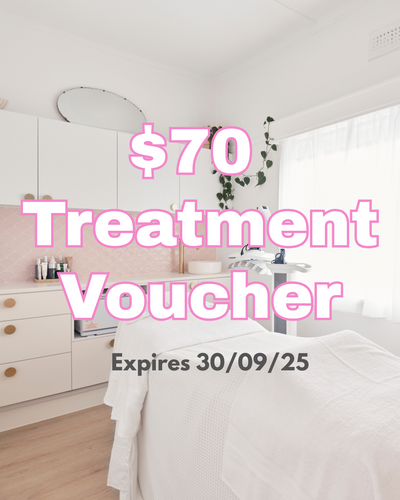 🎁 $70 Treatment Voucher (100% off)
